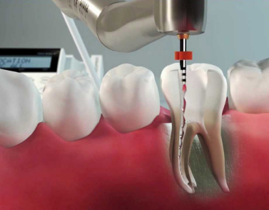 Endodontics